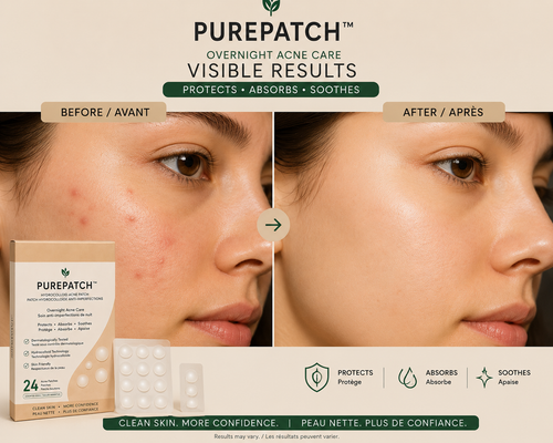 PUREPATCH™ – Patchs Hydrocolloïdes Anti-Imperfections (24 patchs)